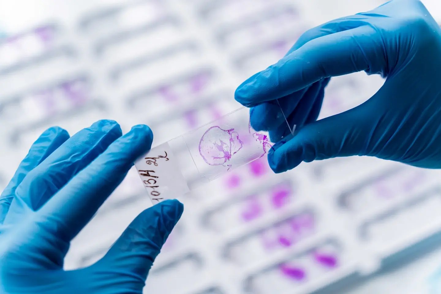 tissus-overview-hero